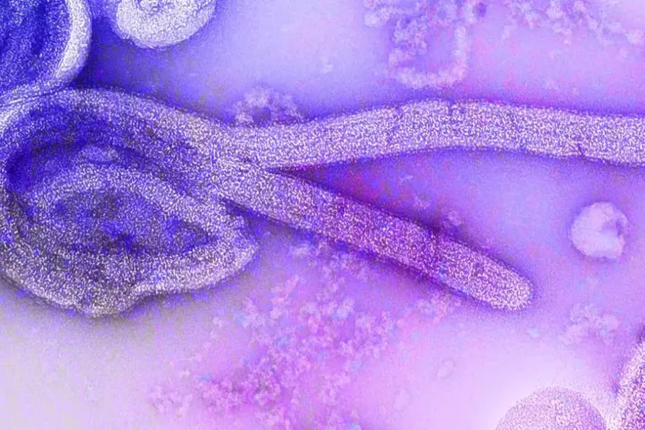 Paciente de Uganda com malária está em isolamento no Rio de Janeiro, aguardando exames para suspeita de Ebola.