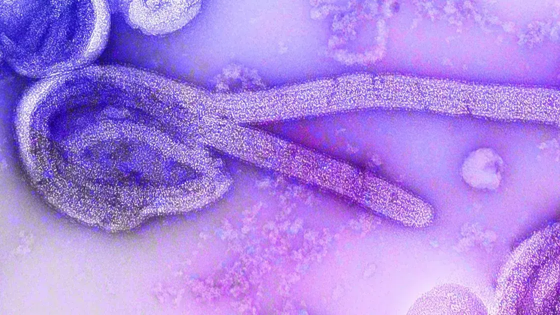 Paciente de Uganda com malária está em isolamento no Rio de Janeiro, aguardando exames para suspeita de Ebola.